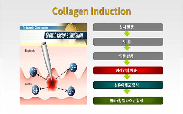Collagen Induction